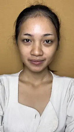 Before after transis
