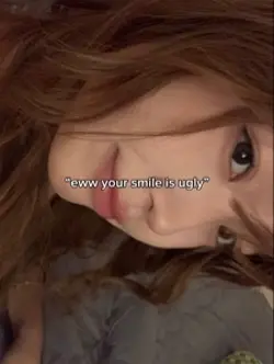 your smile is ugly