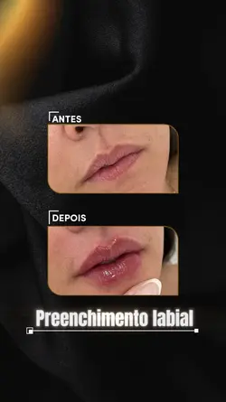 ANTES E DEPOIS