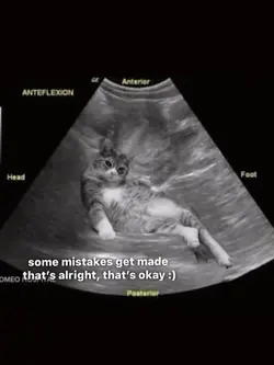 pregnancy prank