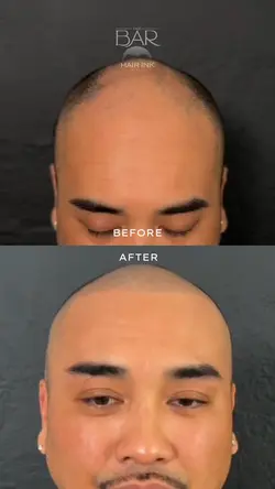 SMP before after 