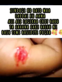 relationship of aama