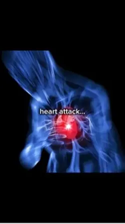 Heart attack