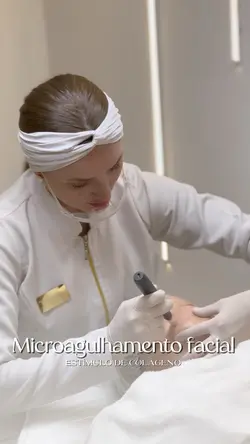 Microagulhamento