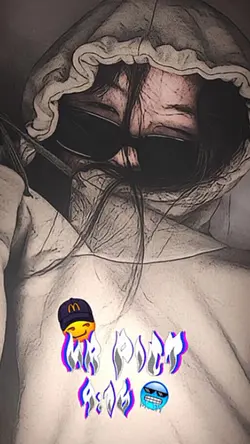 normal