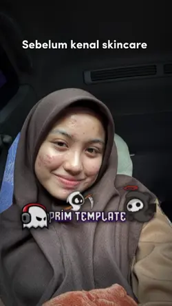 Sebelum knl skincare