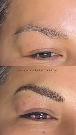 Before after brows