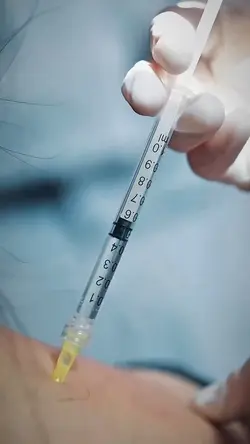 botox facial