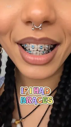 Braces