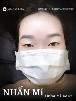 Mí xinh 