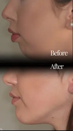 Before vs after