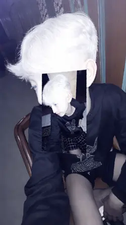 albino trend 