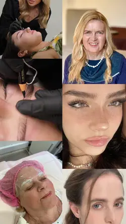 brows