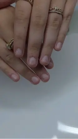 Nails Before/After