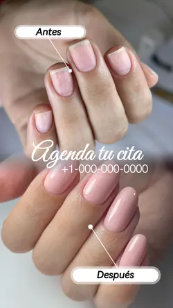 Antes y después uñas