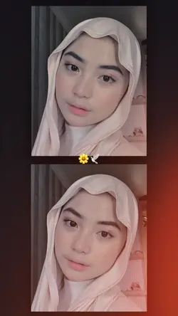 Filter estetik