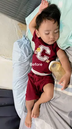 Before after