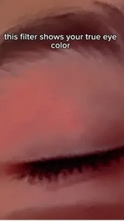 True eye color