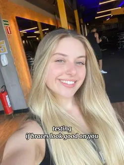 AI braces
