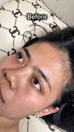 Eyelash extensions