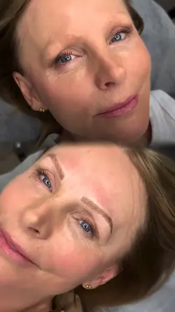 Before after | Brows