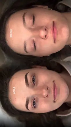 Before after brows