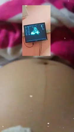 Pregnancy
