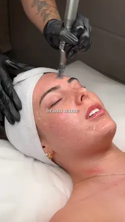 microneedling