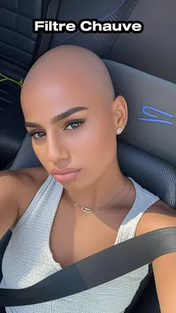 Ai hair bald chauve