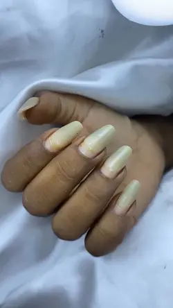Antes e depois nail