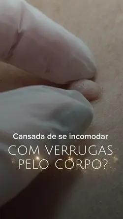 Jato de Plasma