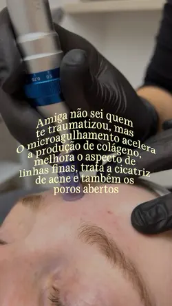 Microagulhamento