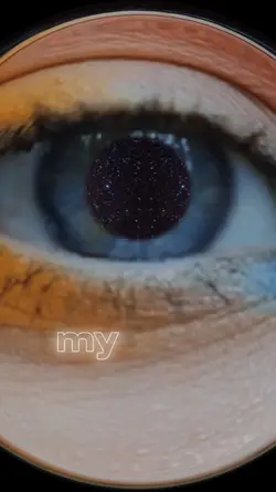 Eye Transition