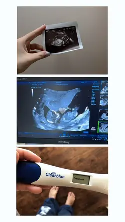 Pregnancy