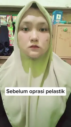 operasi plastik