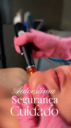 Estética micro agulh
