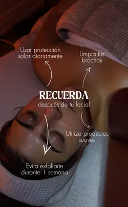 Después de tu facial