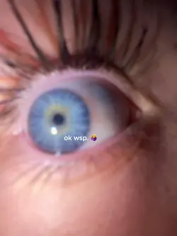 my eyes 🦋🐬