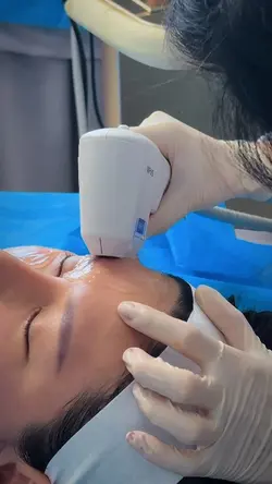 Microneeding
