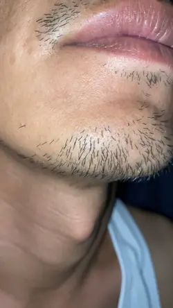 Hair razor