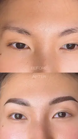 Before After Grid