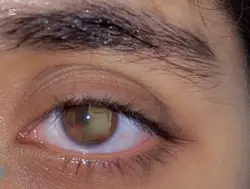 Eye sad edit
