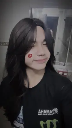 Kiss 💋 