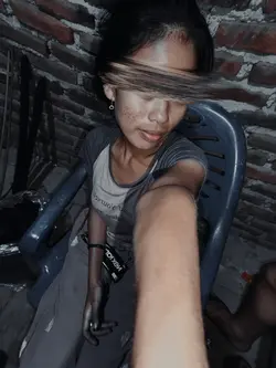 Estetik kane