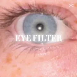 Eye filter