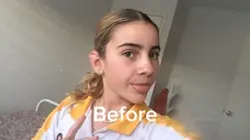 Hair transformation 