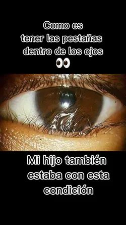 pestañas