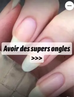 Avoir des ongles >>😍