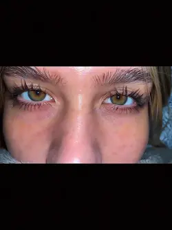 Cancer eyes