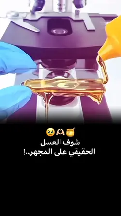 تركت الدنيا حبيته